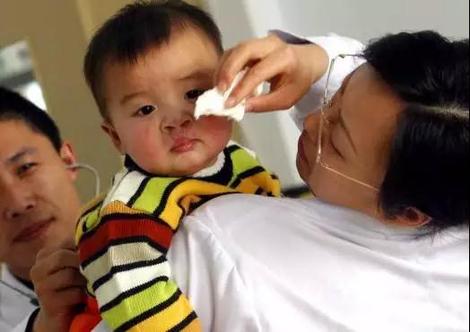 帮助残疾孤儿手术康复的“明天计划”救助唇腭裂儿童